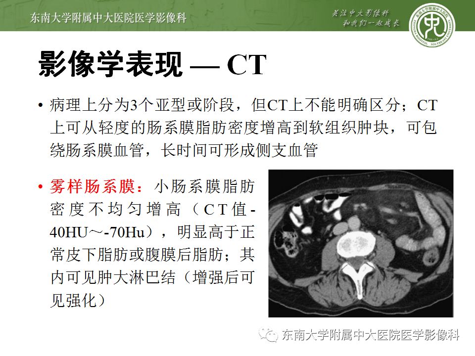 【病例】肠系膜脂膜炎1例CT影像诊断