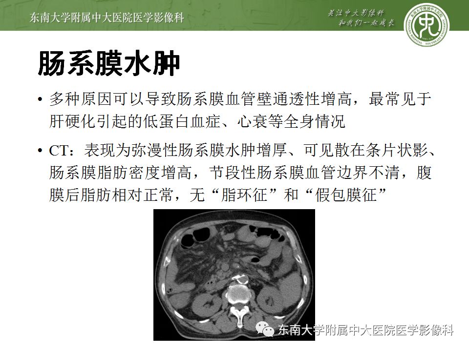 【病例】肠系膜脂膜炎1例CT影像诊断
