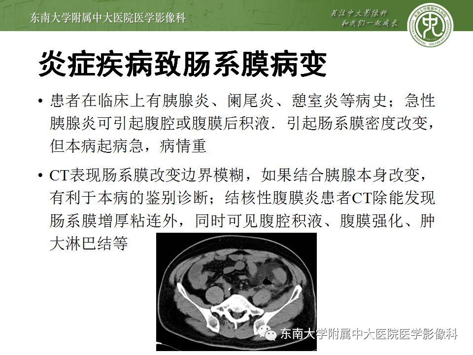 【病例】肠系膜脂膜炎1例CT影像诊断