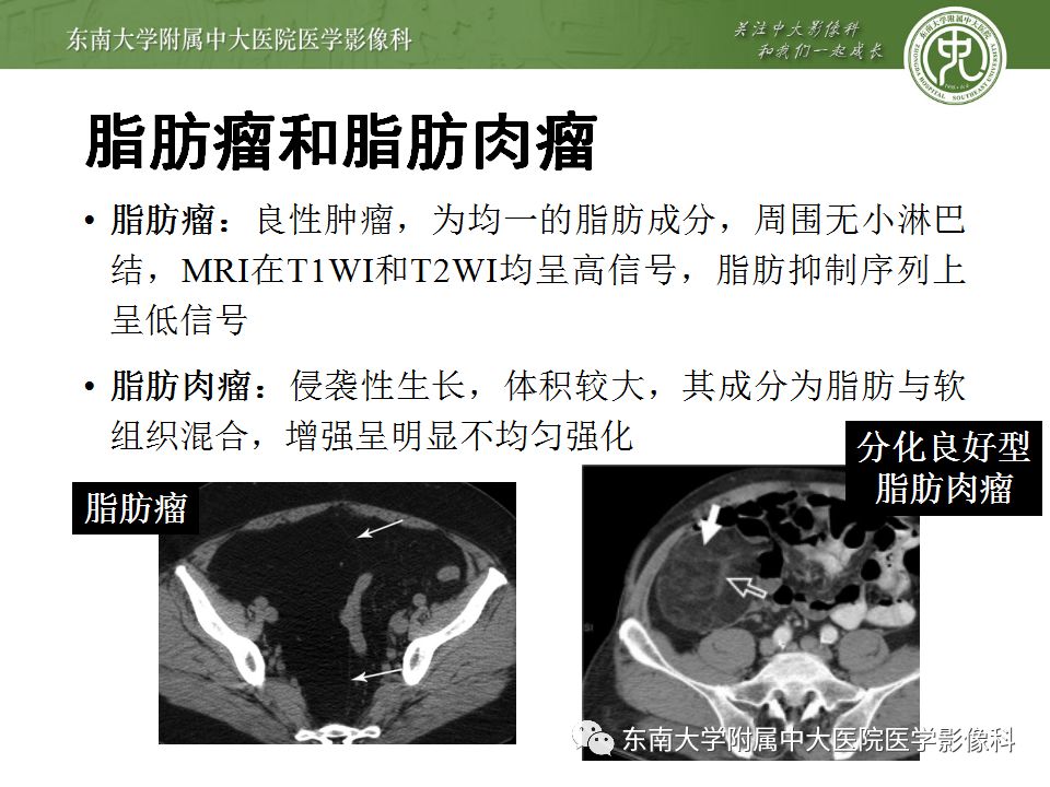 【病例】肠系膜脂膜炎1例CT影像诊断