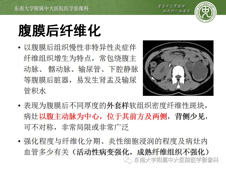 【病例】肠系膜脂膜炎1例CT影像诊断