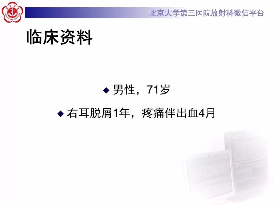 【病例】外耳道鳞癌1例CT及MR影像表现