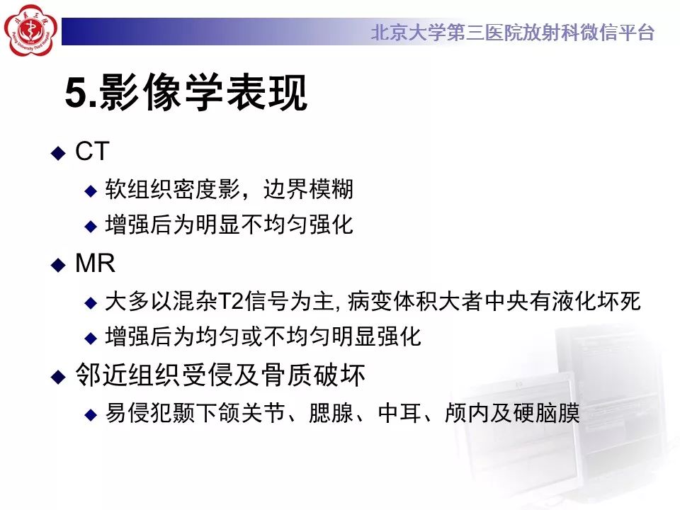 【病例】外耳道鳞癌1例CT及MR影像表现