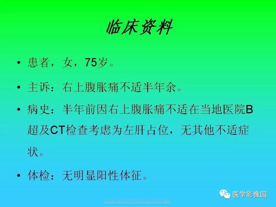 【病例】肝脏孤立性纤维瘤1例CT影像表现