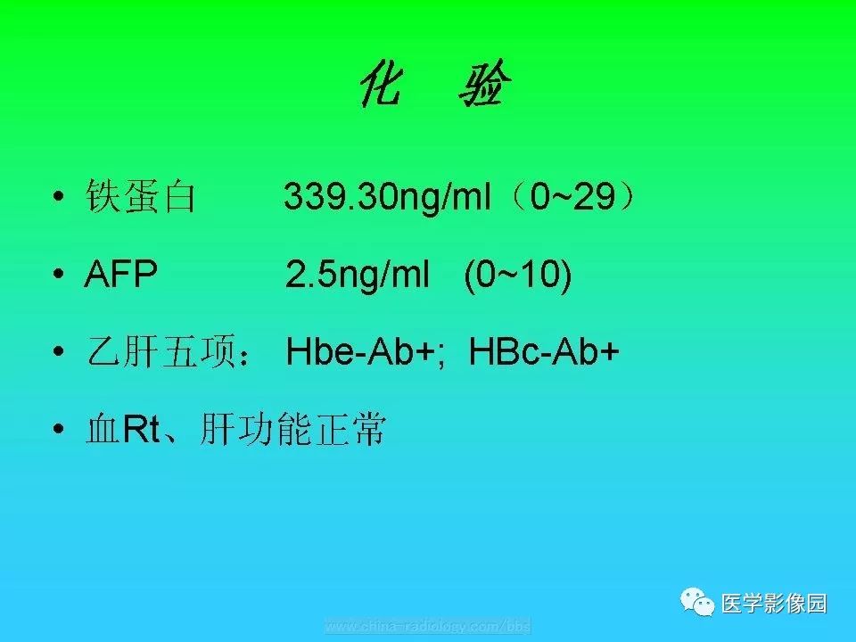 【病例】肝脏孤立性纤维瘤1例CT影像表现
