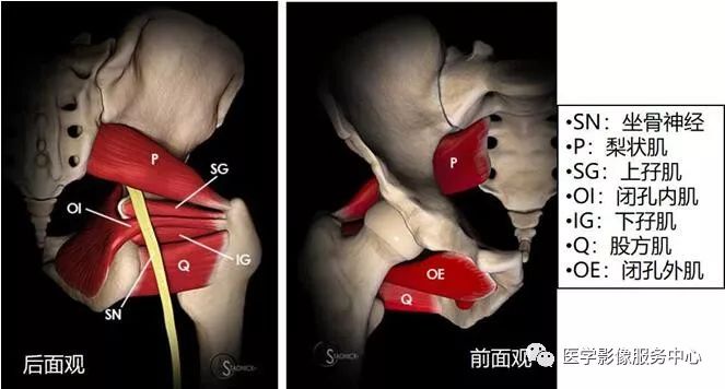 掌握这个公式,秒杀坐骨股骨撞击综合征 掌握这个公式,秒杀坐骨股骨撞击综合征