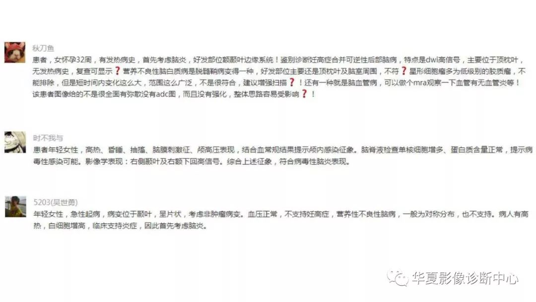 【病例】病毒性脑炎1例MR