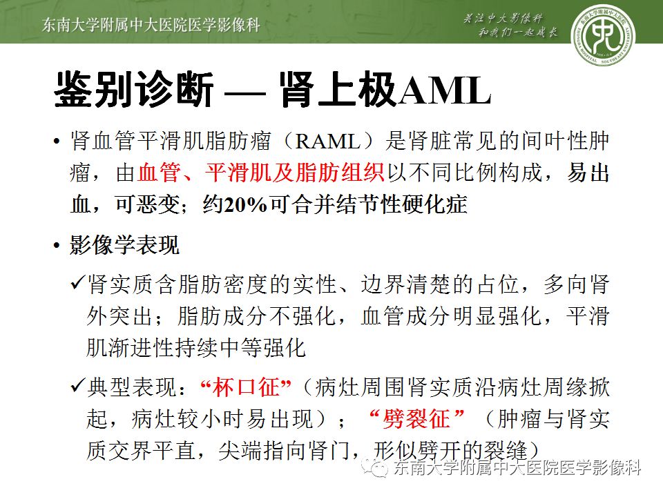 【病例】肾上腺髓脂瘤1例CT影像诊断