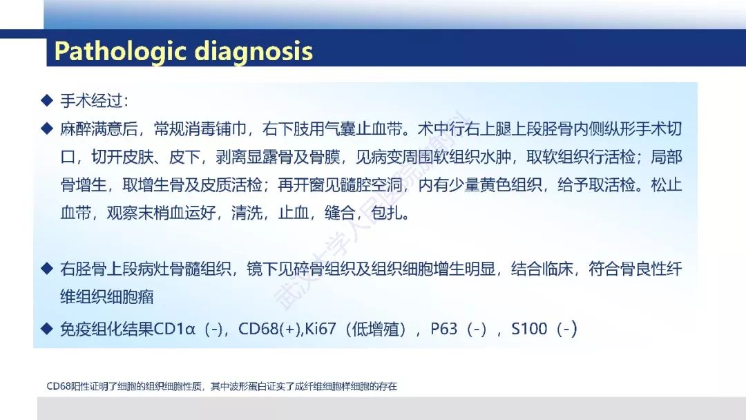 【病例】胫骨良性纤维组织细胞瘤1例X线MR