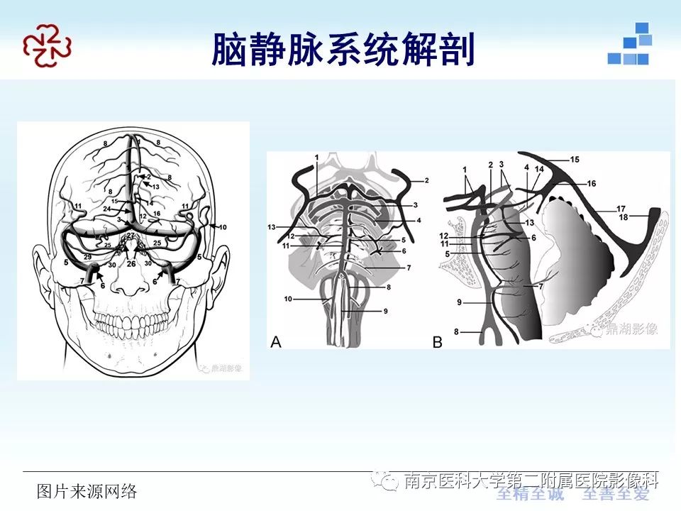 【PPT】脑静脉窦血栓合并脑实质损害的MRI影像学特征