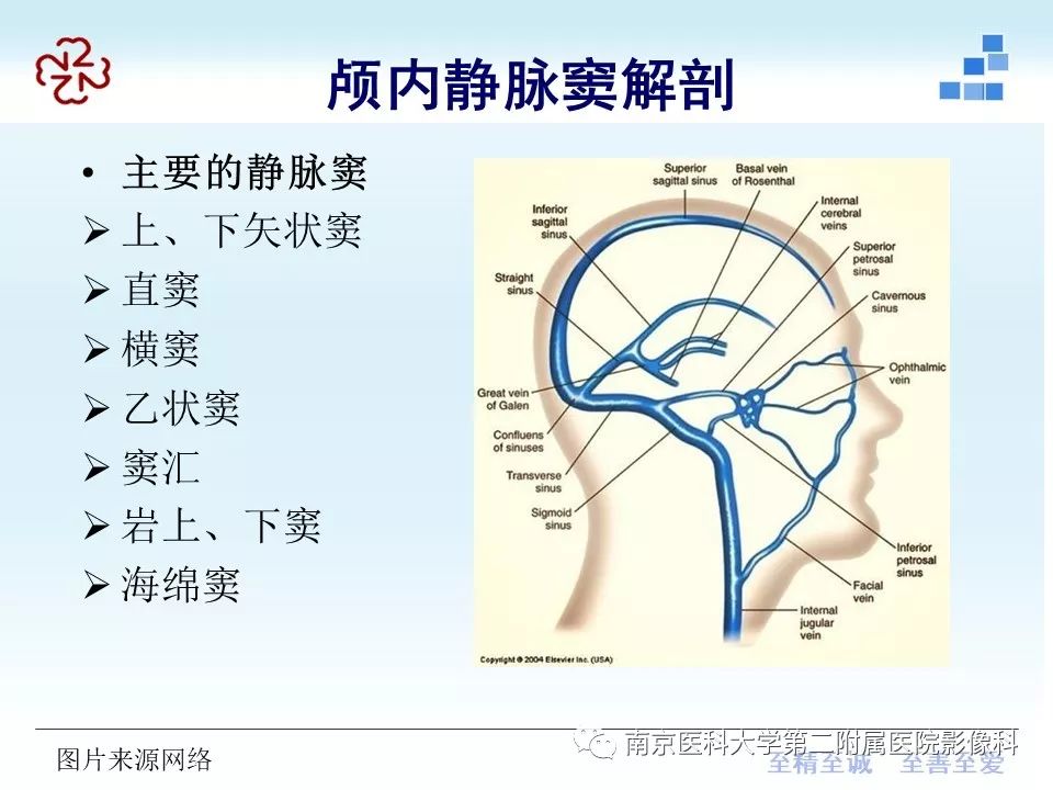 【PPT】脑静脉窦血栓合并脑实质损害的MRI影像学特征