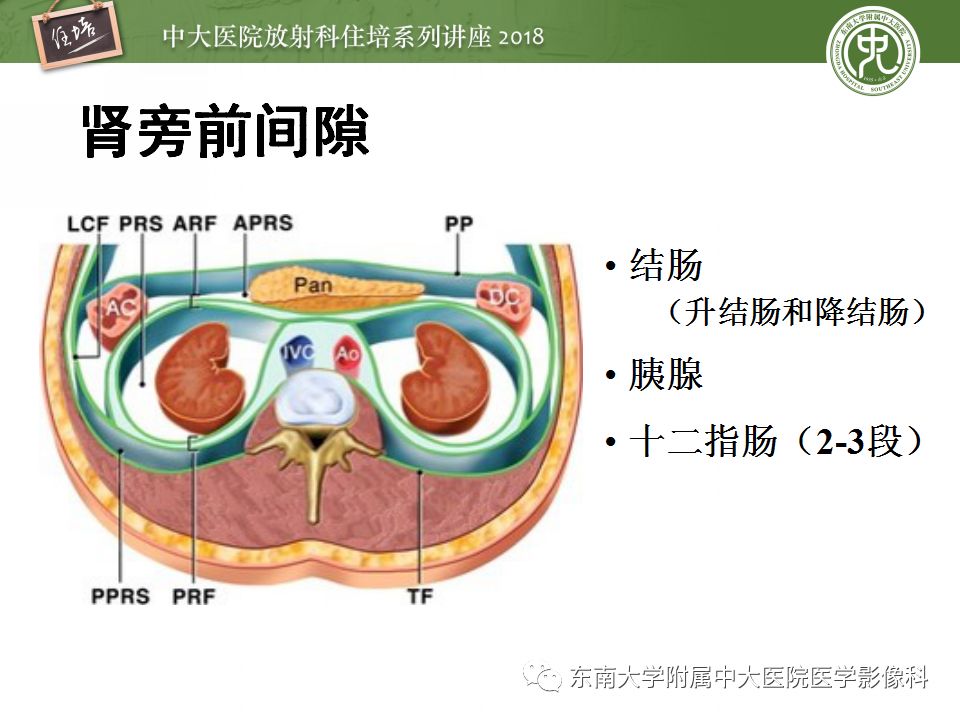 【PPT】中腹部基于器官和影像特点的鉴别诊断
