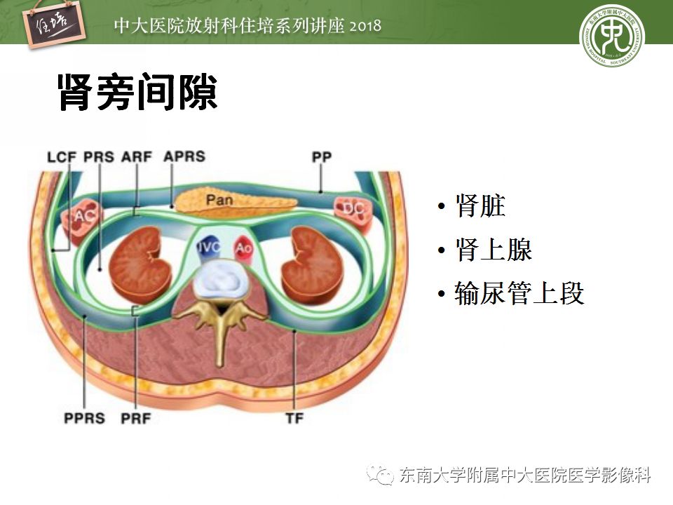 【PPT】中腹部基于器官和影像特点的鉴别诊断