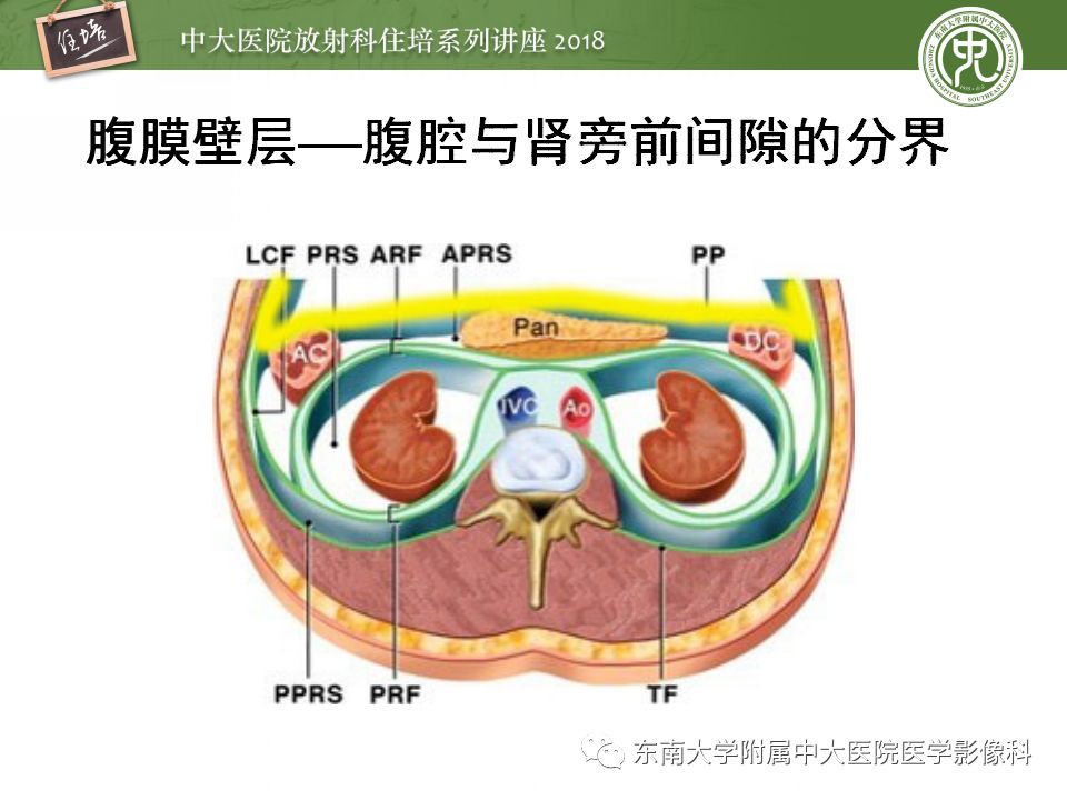 【PPT】中腹部基于器官和影像特点的鉴别诊断