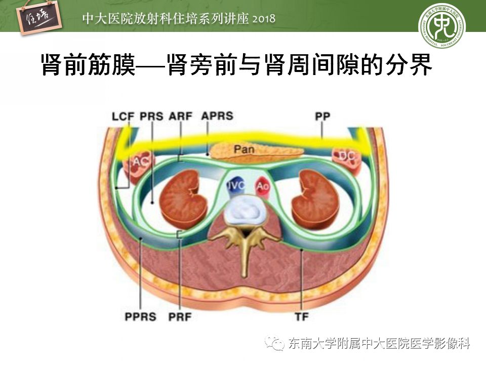 【PPT】中腹部基于器官和影像特点的鉴别诊断