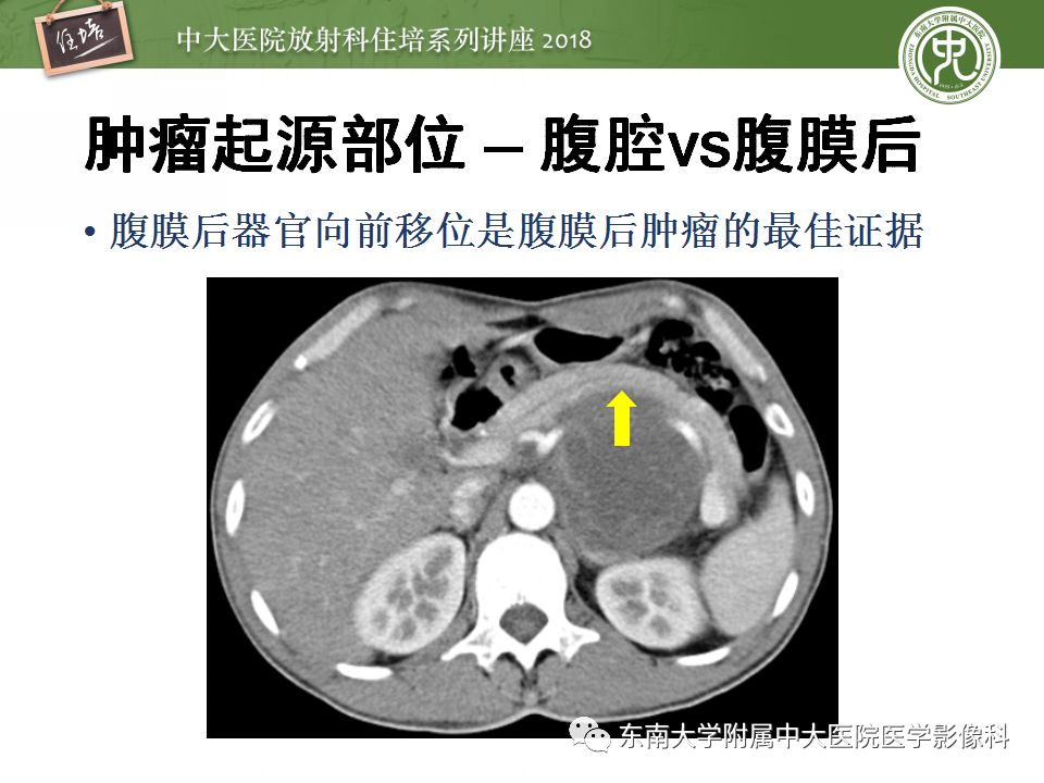 【PPT】中腹部基于器官和影像特点的鉴别诊断