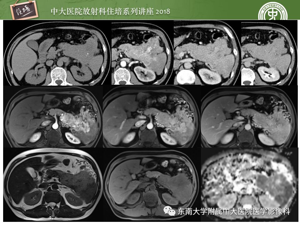 【PPT】中腹部基于器官和影像特点的鉴别诊断