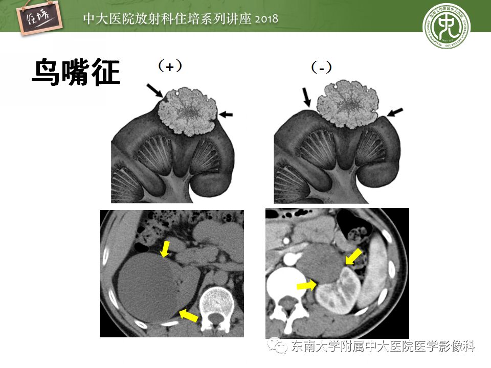 【PPT】中腹部基于器官和影像特点的鉴别诊断