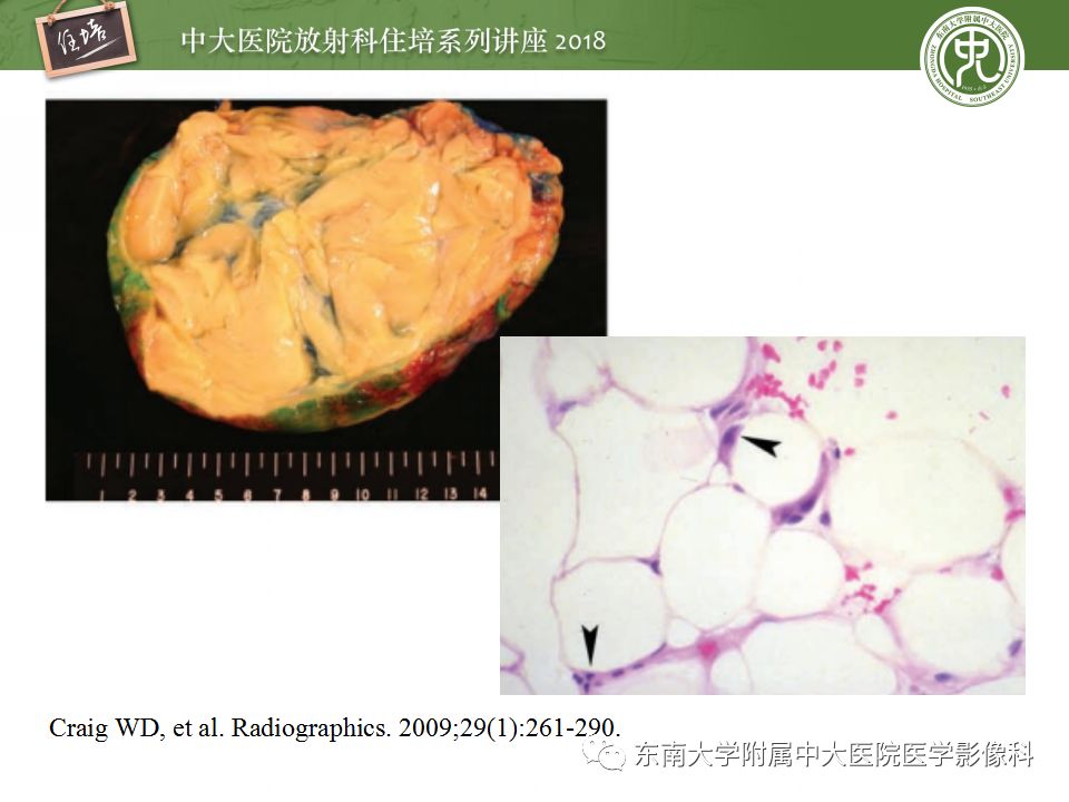【PPT】中腹部基于器官和影像特点的鉴别诊断