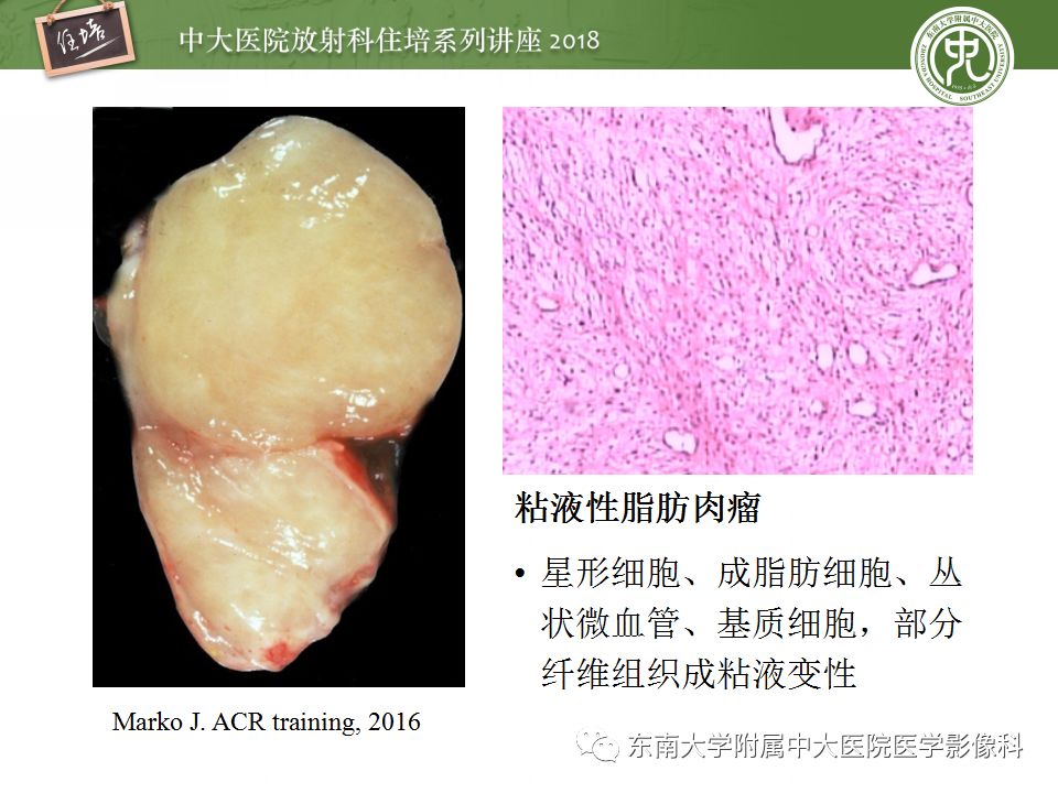 【PPT】中腹部基于器官和影像特点的鉴别诊断
