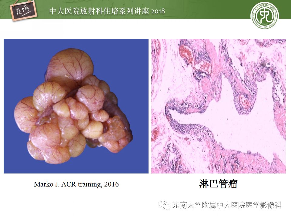 【PPT】中腹部基于器官和影像特点的鉴别诊断