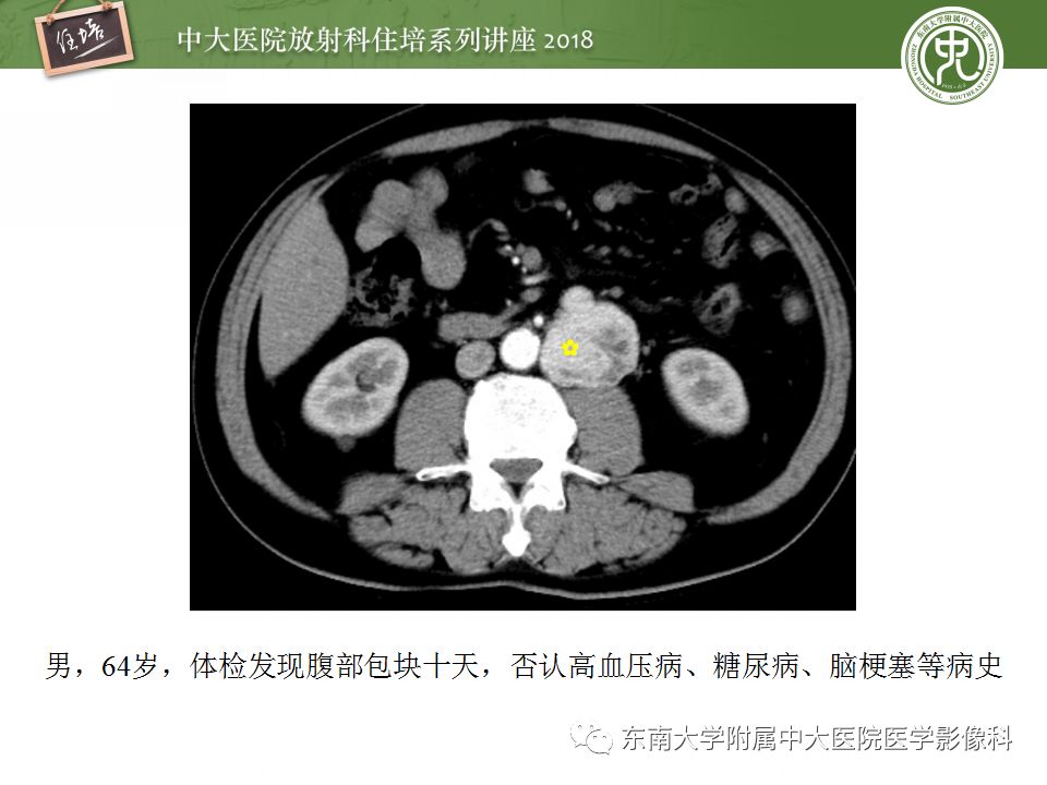 【PPT】中腹部基于器官和影像特点的鉴别诊断
