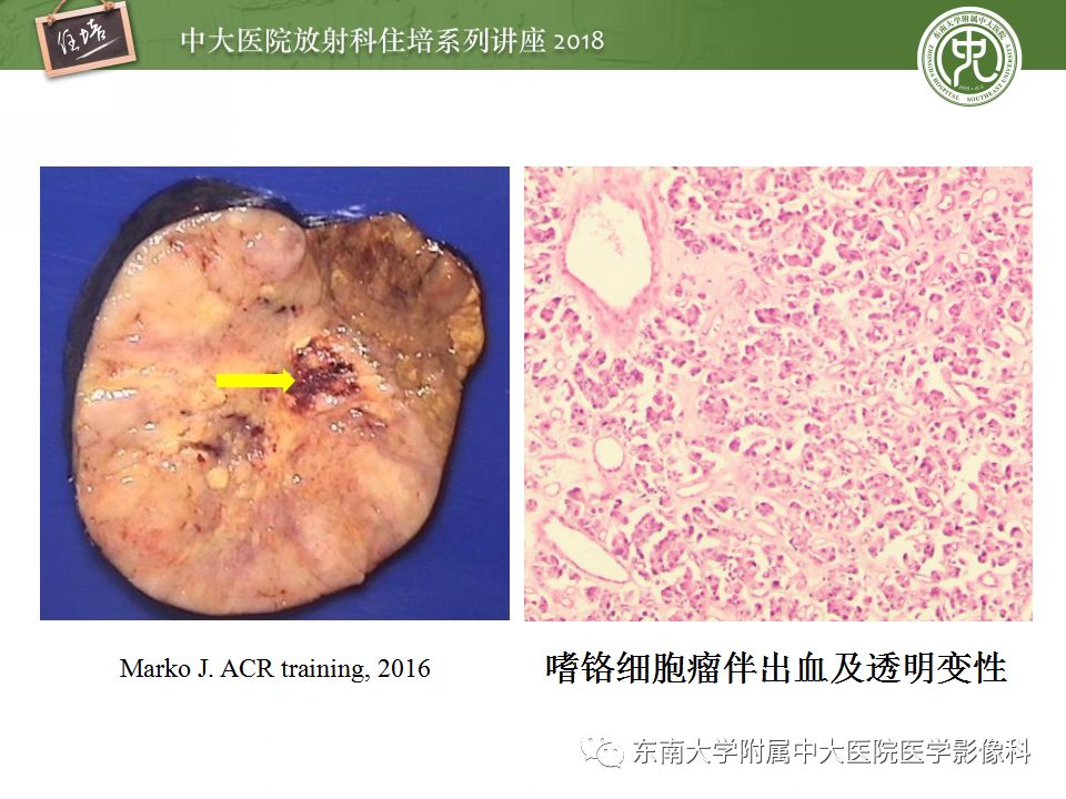 【PPT】中腹部基于器官和影像特点的鉴别诊断