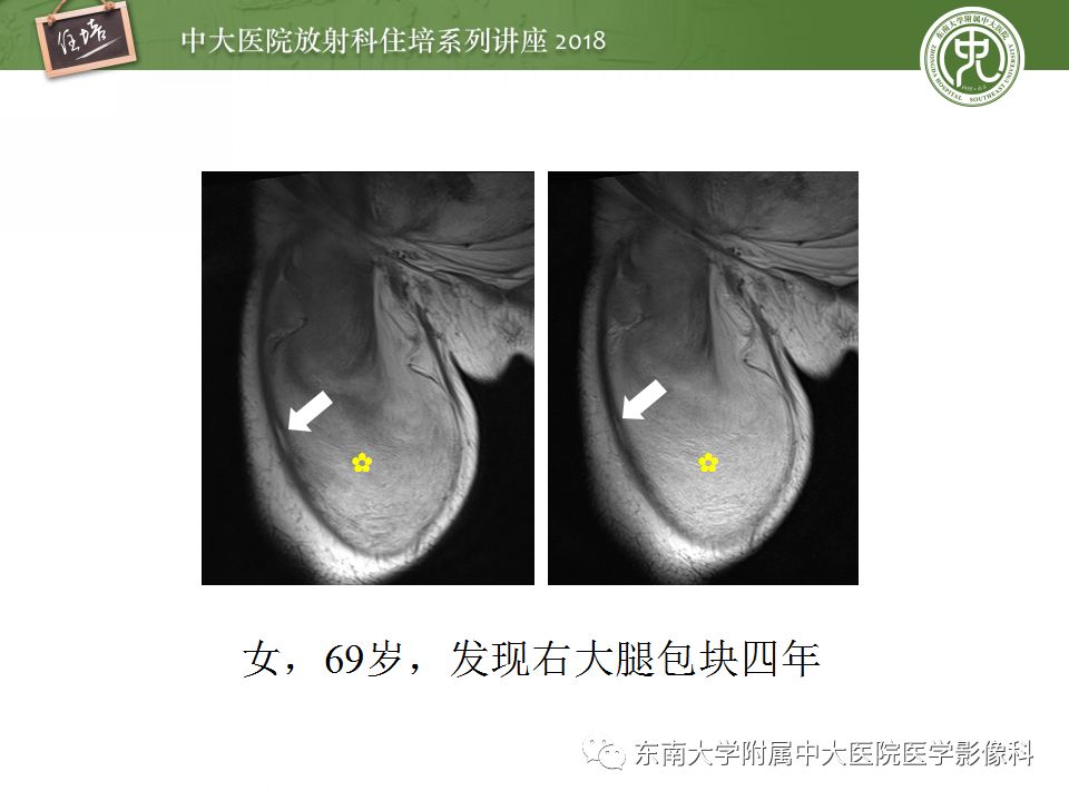 【PPT】中腹部基于器官和影像特点的鉴别诊断