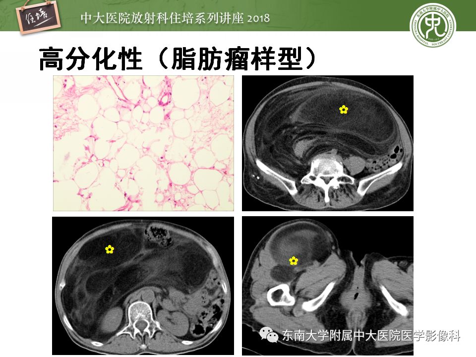 【PPT】中腹部基于器官和影像特点的鉴别诊断