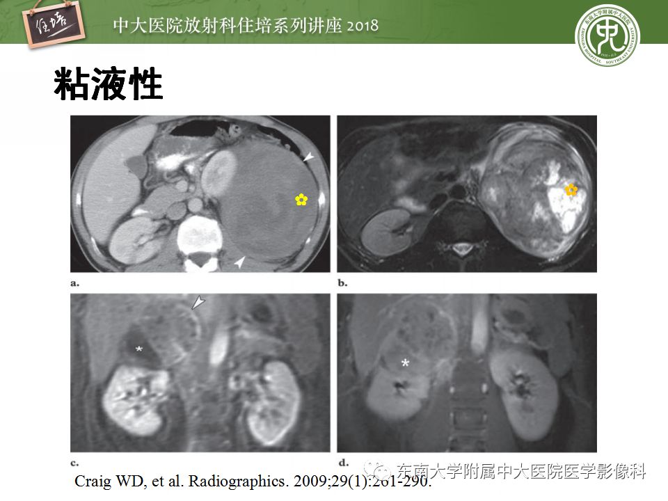 【PPT】中腹部基于器官和影像特点的鉴别诊断