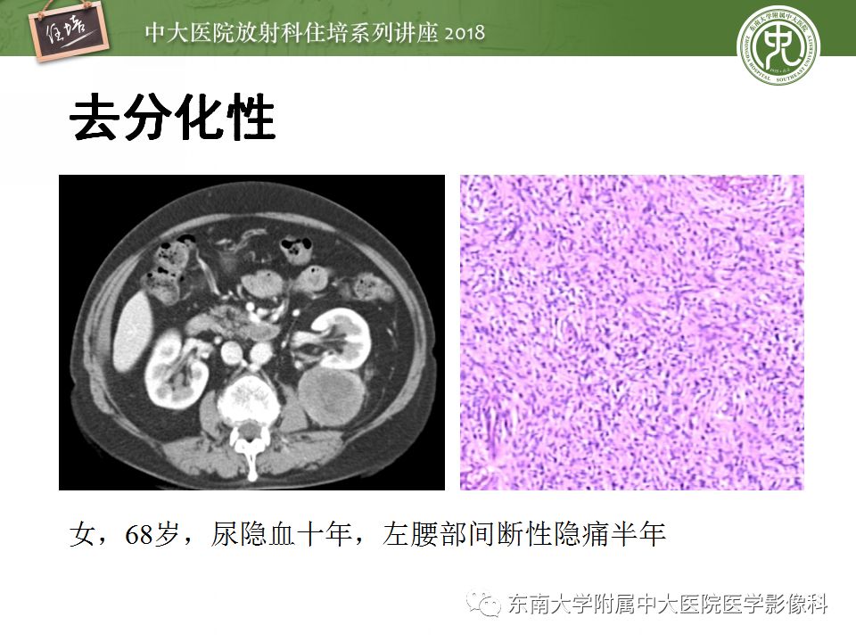 【PPT】中腹部基于器官和影像特点的鉴别诊断