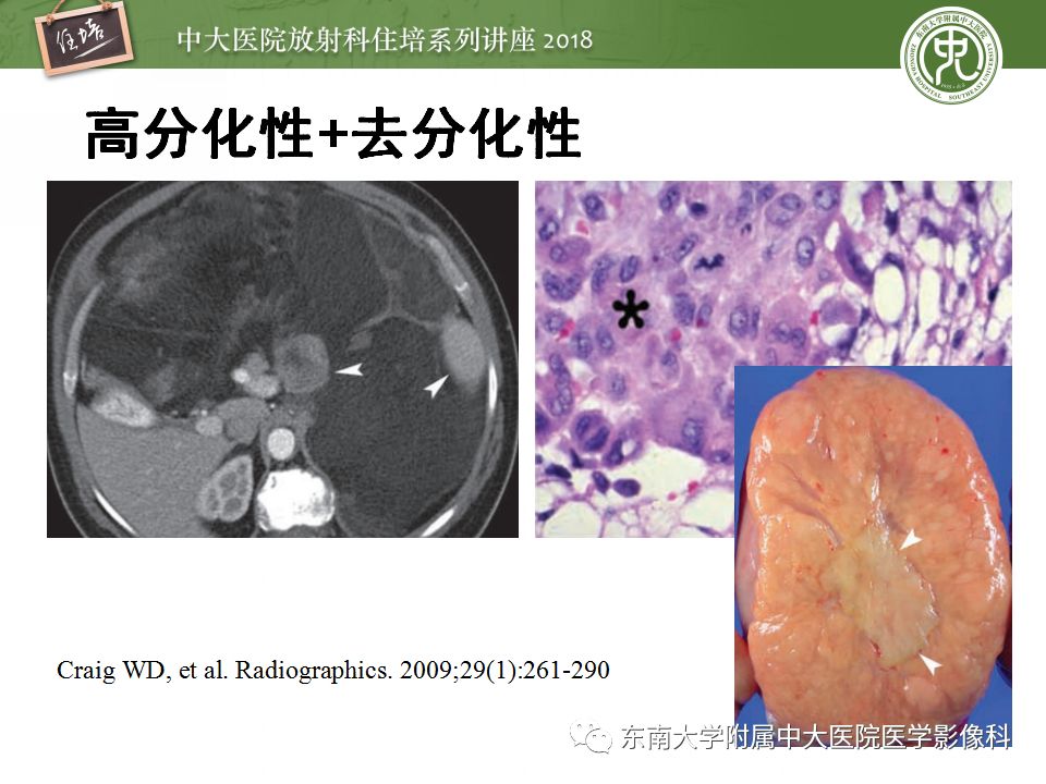 【PPT】中腹部基于器官和影像特点的鉴别诊断