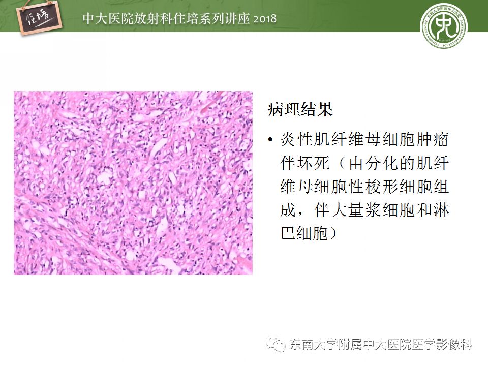 【PPT】中腹部基于器官和影像特点的鉴别诊断