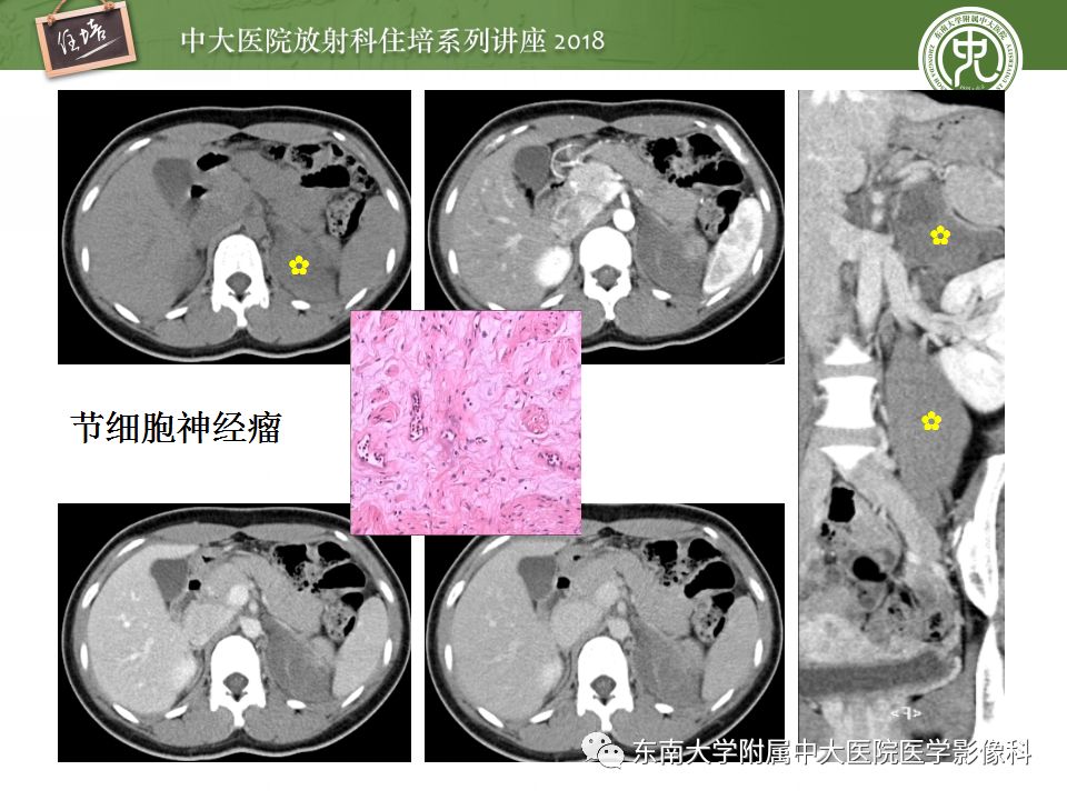 【PPT】中腹部基于器官和影像特点的鉴别诊断