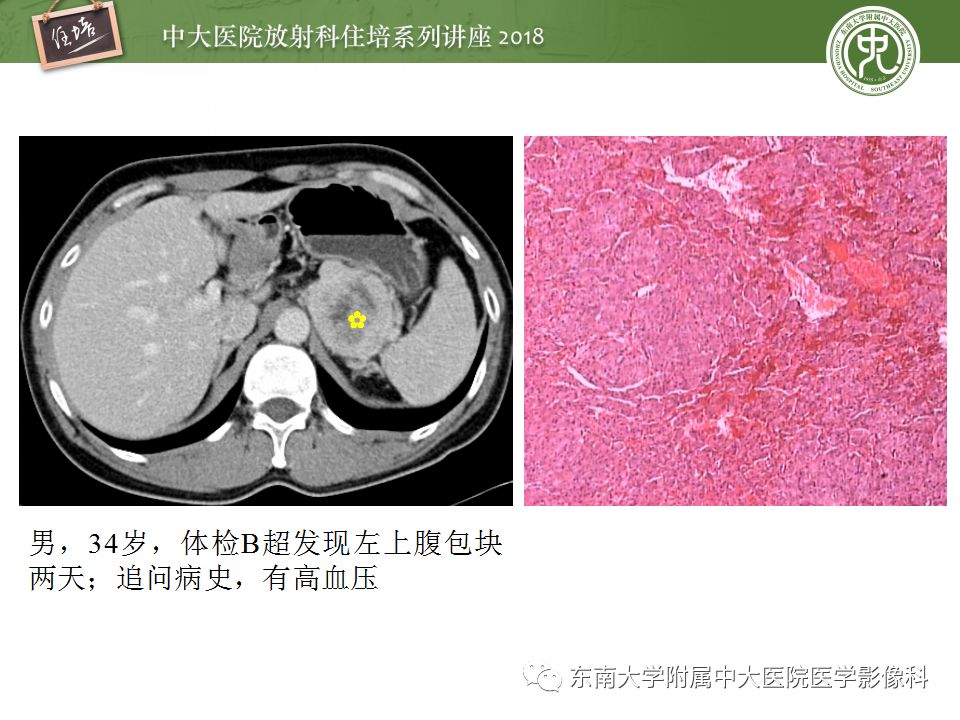 【PPT】中腹部基于器官和影像特点的鉴别诊断