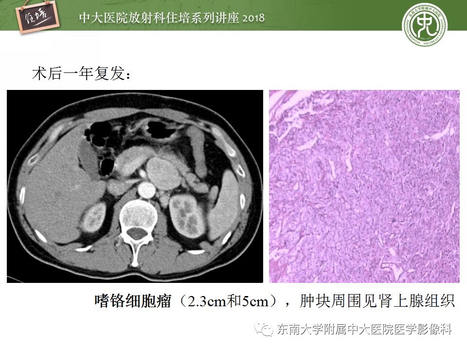【PPT】中腹部基于器官和影像特点的鉴别诊断