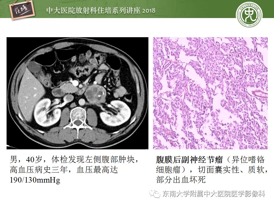 【PPT】中腹部基于器官和影像特点的鉴别诊断