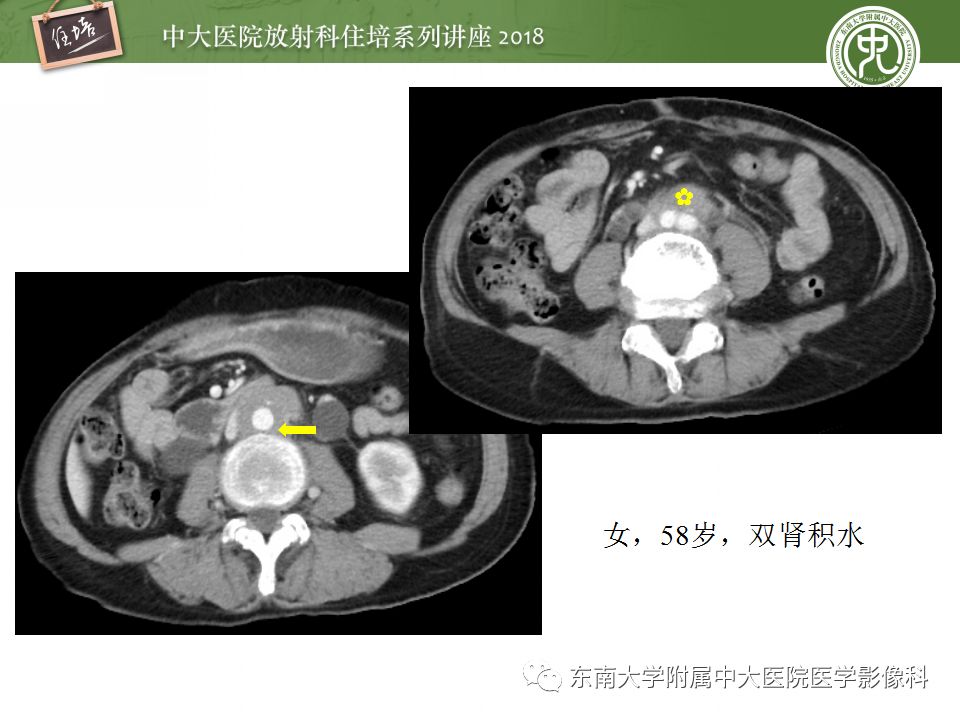 【PPT】中腹部基于器官和影像特点的鉴别诊断
