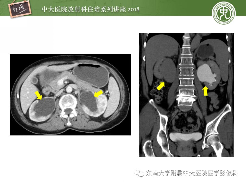 【PPT】中腹部基于器官和影像特点的鉴别诊断