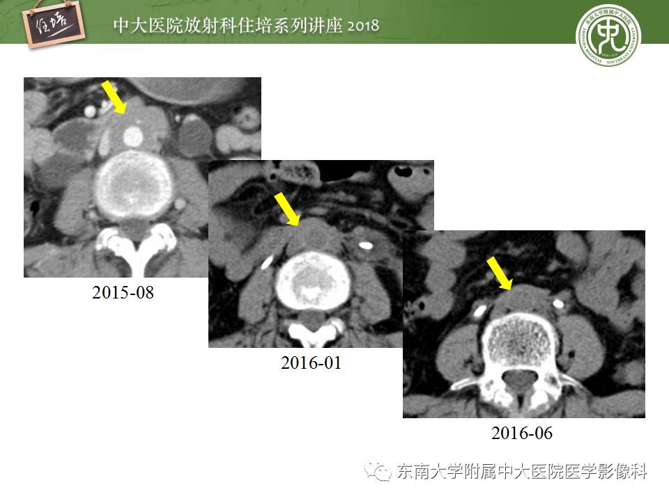 【PPT】中腹部基于器官和影像特点的鉴别诊断