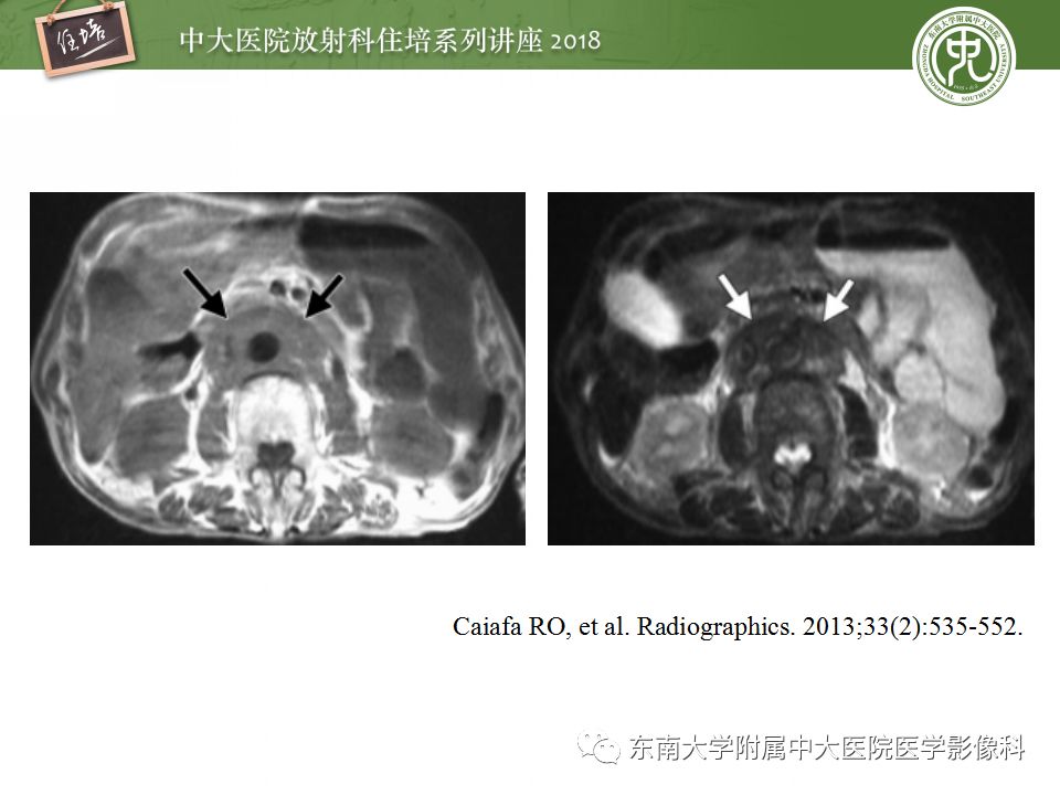 【PPT】中腹部基于器官和影像特点的鉴别诊断