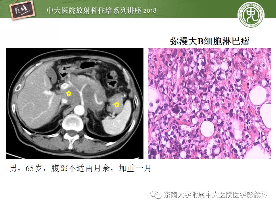 【PPT】中腹部基于器官和影像特点的鉴别诊断