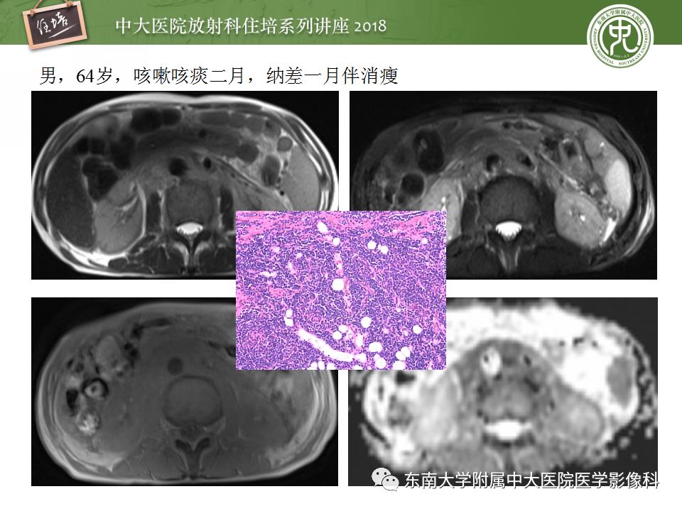 【PPT】中腹部基于器官和影像特点的鉴别诊断