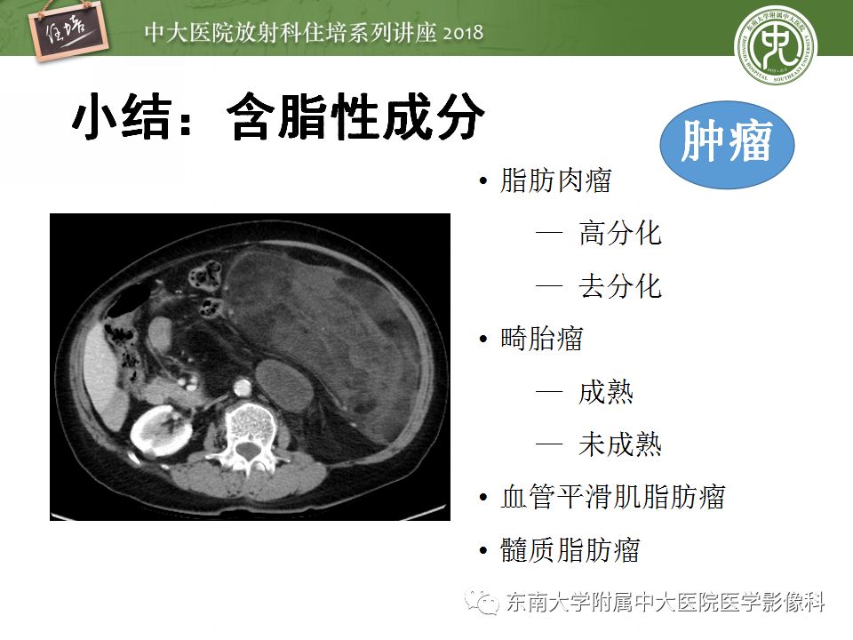 【PPT】中腹部基于器官和影像特点的鉴别诊断