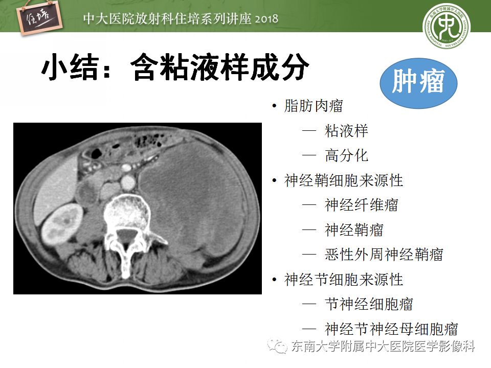 【PPT】中腹部基于器官和影像特点的鉴别诊断