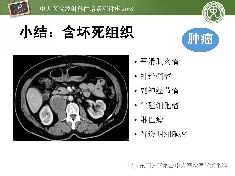 【PPT】中腹部基于器官和影像特点的鉴别诊断