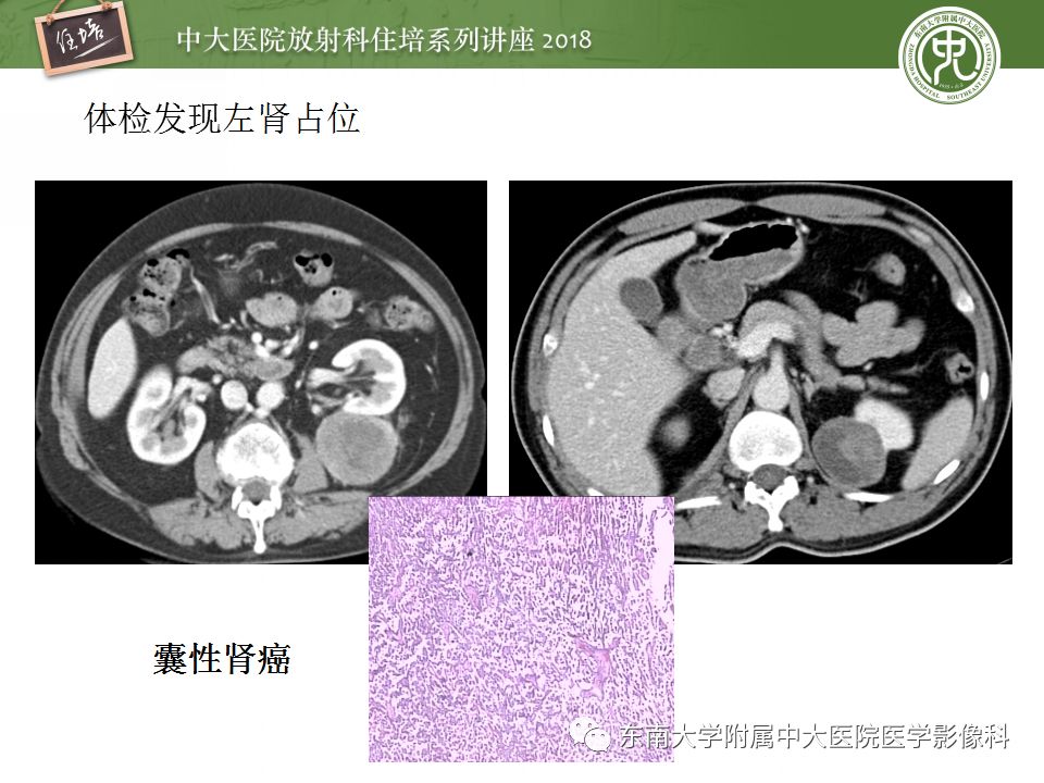 【PPT】中腹部基于器官和影像特点的鉴别诊断