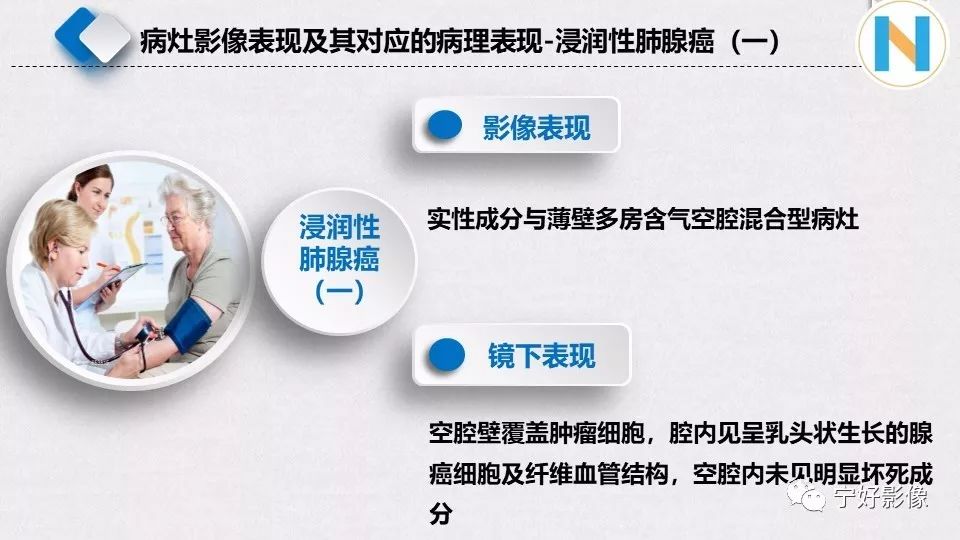 【PPT】含薄壁囊腔周围型肺癌的CT特征及病理分析 【PPT】含薄壁囊腔周围型肺癌的CT特征及病理分析