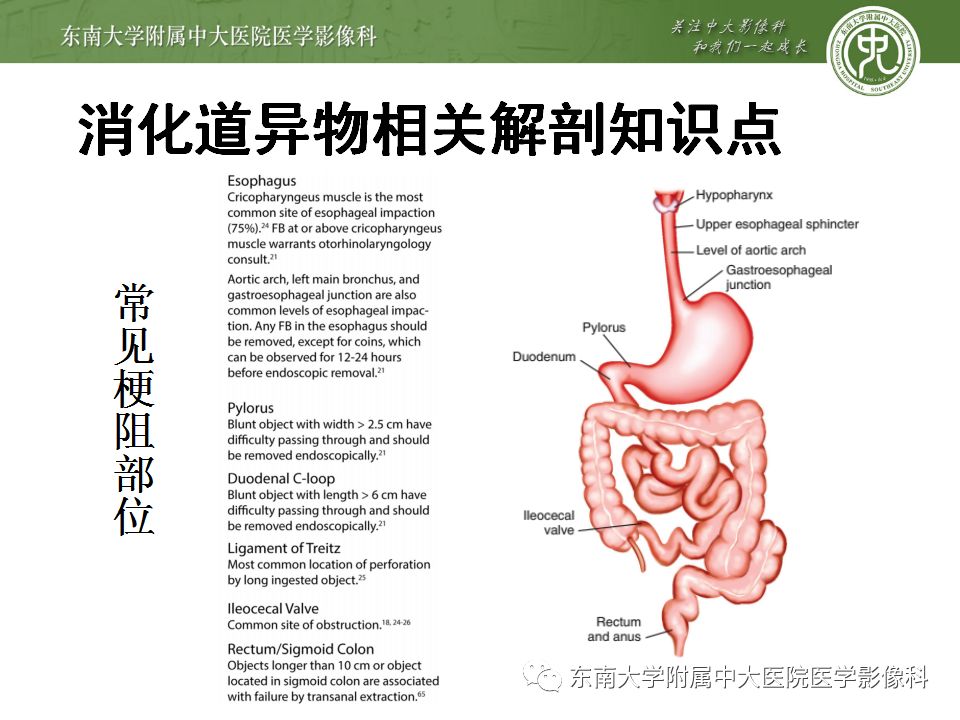 【病例】消化道及呼吸道异物4例CT