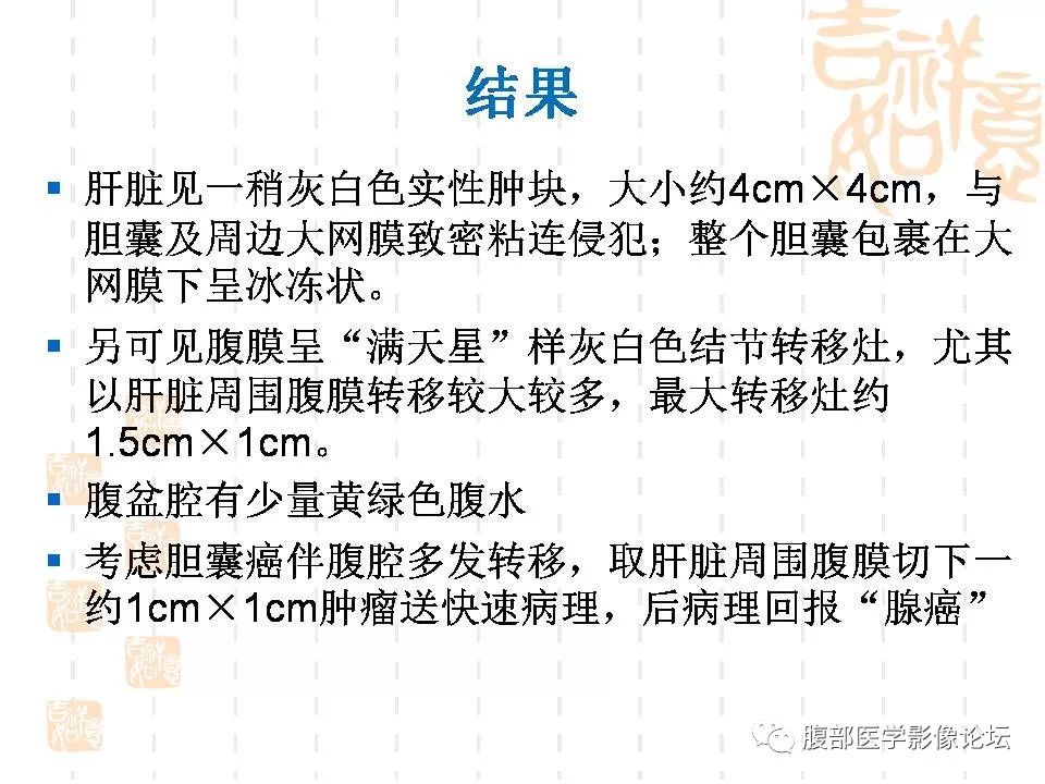 【病例】胆囊癌1例CT及MR影像表现